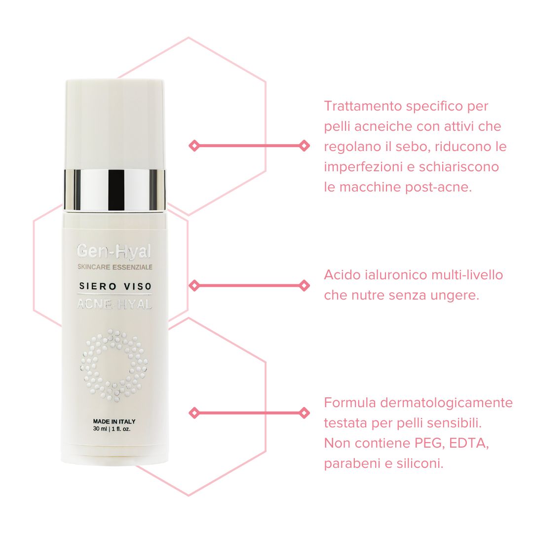 Siero-viso-keypoints Siero viso keypoints